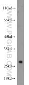 Vestigial Like Family Member 1 antibody, 10124-2-AP, Proteintech Group, Western Blot image 