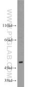 Activation Induced Cytidine Deaminase antibody, 15642-1-AP, Proteintech Group, Western Blot image 