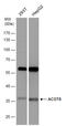 Acyl-CoA Thioesterase 8 antibody, GTX103960, GeneTex, Western Blot image 