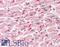 Junction Plakoglobin antibody, LS-B2204, Lifespan Biosciences, Immunohistochemistry paraffin image 
