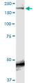 Sodium Voltage-Gated Channel Alpha Subunit 9 antibody, LS-C198154, Lifespan Biosciences, Western Blot image 