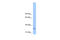 Phospholipid Phosphatase Related 2 antibody, 30-544, ProSci, Enzyme Linked Immunosorbent Assay image 