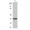 Growth Hormone Regulated TBC Protein 1 antibody, LS-C383860, Lifespan Biosciences, Western Blot image 