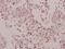 Cathepsin H antibody, A01510Y205, Boster Biological Technology, Immunohistochemistry frozen image 