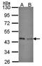 Isovaleryl-CoA Dehydrogenase antibody, orb69799, Biorbyt, Western Blot image 