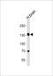 Zinc Finger Protein 423 antibody, PA5-49368, Invitrogen Antibodies, Western Blot image 