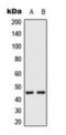 Mitogen-Activated Protein Kinase Kinase 1 antibody, orb224177, Biorbyt, Western Blot image 