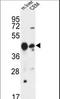 Phospholipase A1 Member A antibody, LS-C163754, Lifespan Biosciences, Western Blot image 