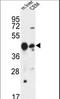 Phospholipase A1 member A antibody, LS-C163754, Lifespan Biosciences, Western Blot image 