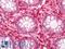 Annexin A5 antibody, LS-C211252, Lifespan Biosciences, Immunohistochemistry paraffin image 