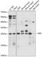 Ribulose-5-Phosphate-3-Epimerase antibody, GTX66288, GeneTex, Western Blot image 