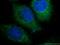 DENN Domain Containing 1A antibody, 25658-1-AP, Proteintech Group, Immunofluorescence image 