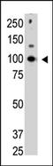 Cbl Proto-Oncogene C antibody, AP11262PU-N, Origene, Western Blot image 