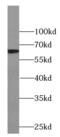 Cytosolic Thiouridylase Subunit 2 antibody, FNab01038, FineTest, Western Blot image 