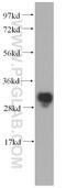 Methyltransferase Like 1 antibody, 14994-1-AP, Proteintech Group, Western Blot image 