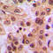 NFKB Inhibitor Alpha antibody, LS-C352590, Lifespan Biosciences, Immunohistochemistry paraffin image 