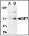 Interferon Regulatory Factor 7 antibody, NBP1-02718, Novus Biologicals, Western Blot image 