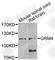 Glutamate Metabotropic Receptor 4 antibody, A7284, ABclonal Technology, Western Blot image 