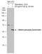 SMAD Family Member 3 antibody, GTX129841, GeneTex, Western Blot image 