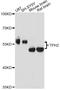 Tryptophan Hydroxylase 2 antibody, LS-C749524, Lifespan Biosciences, Western Blot image 