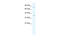 Minichromosome Maintenance Complex Component 4 antibody, 28-536, ProSci, Western Blot image 