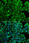 HLA class II histocompatibility antigen, DRB1-15 beta chain antibody, A00568-1, Boster Biological Technology, Immunofluorescence image 