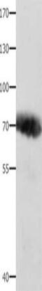 Alpha Fetoprotein antibody, CSB-PA251527, Cusabio, Western Blot image 