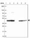 Stomatin Like 2 antibody, NBP2-38943, Novus Biologicals, Western Blot image 