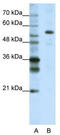 Cleavage And Polyadenylation Specific Factor 7 antibody, TA343932, Origene, Western Blot image 