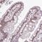 Interferon Regulatory Factor 1 antibody, PA5-64093, Invitrogen Antibodies, Immunohistochemistry paraffin image 