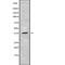 Carcinoembryonic Antigen Related Cell Adhesion Molecule 8 antibody, abx149192, Abbexa, Western Blot image 
