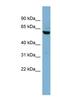 Nectin Cell Adhesion Molecule 3 antibody, NBP1-59519, Novus Biologicals, Western Blot image 