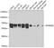 Ribosomal Protein S6 Kinase B2 antibody, 16-035, ProSci, Western Blot image 
