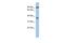 Radial Spoke Head 10 Homolog B2 antibody, GTX45125, GeneTex, Western Blot image 