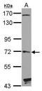 Hedgehog Interacting Protein antibody, PA5-29529, Invitrogen Antibodies, Western Blot image 