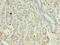 Kelch Like ECH Associated Protein 1 antibody, LS-C369869, Lifespan Biosciences, Immunohistochemistry paraffin image 