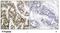 Nuclear Factor Kappa B Subunit 1 antibody, NB100-82074, Novus Biologicals, Immunohistochemistry paraffin image 