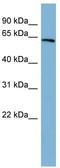 HNF1 Homeobox A antibody, TA344549, Origene, Western Blot image 