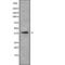 SH3 Domain Containing GRB2 Like 3, Endophilin A3 antibody, abx218570, Abbexa, Western Blot image 