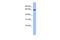 Leucine Zipper Tumor Suppressor 2 antibody, PA5-44945, Invitrogen Antibodies, Western Blot image 