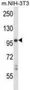 Leukocyte Receptor Tyrosine Kinase antibody, abx027837, Abbexa, Western Blot image 