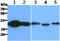 Carbonyl Reductase 1 antibody, GTX57624, GeneTex, Western Blot image 