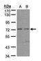 Fibronectin Leucine Rich Transmembrane Protein 1 antibody, LS-C185713, Lifespan Biosciences, Western Blot image 