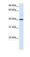 Glutamic-Oxaloacetic Transaminase 2 antibody, orb330305, Biorbyt, Western Blot image 