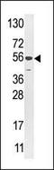 Ubiquitin Specific Peptidase 16 antibody, PA5-12019, Invitrogen Antibodies, Western Blot image 