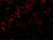 BH3 Interacting Domain Death Agonist antibody, A00730-1, Boster Biological Technology, Immunofluorescence image 