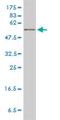 Hypoxanthine Phosphoribosyltransferase 1 antibody, H00003251-M01, Novus Biologicals, Western Blot image 