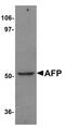 Alpha Fetoprotein antibody, PA5-21004, Invitrogen Antibodies, Western Blot image 