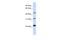 Family With Sequence Similarity 153 Member B antibody, A18699, Boster Biological Technology, Western Blot image 