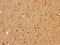 Secretagogin, EF-Hand Calcium Binding Protein antibody, LS-C396879, Lifespan Biosciences, Immunohistochemistry paraffin image 